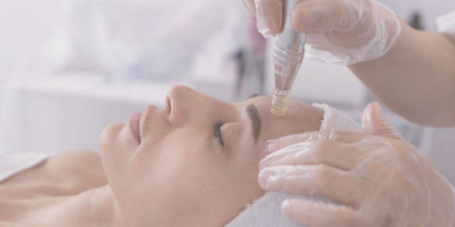 Skin Needling