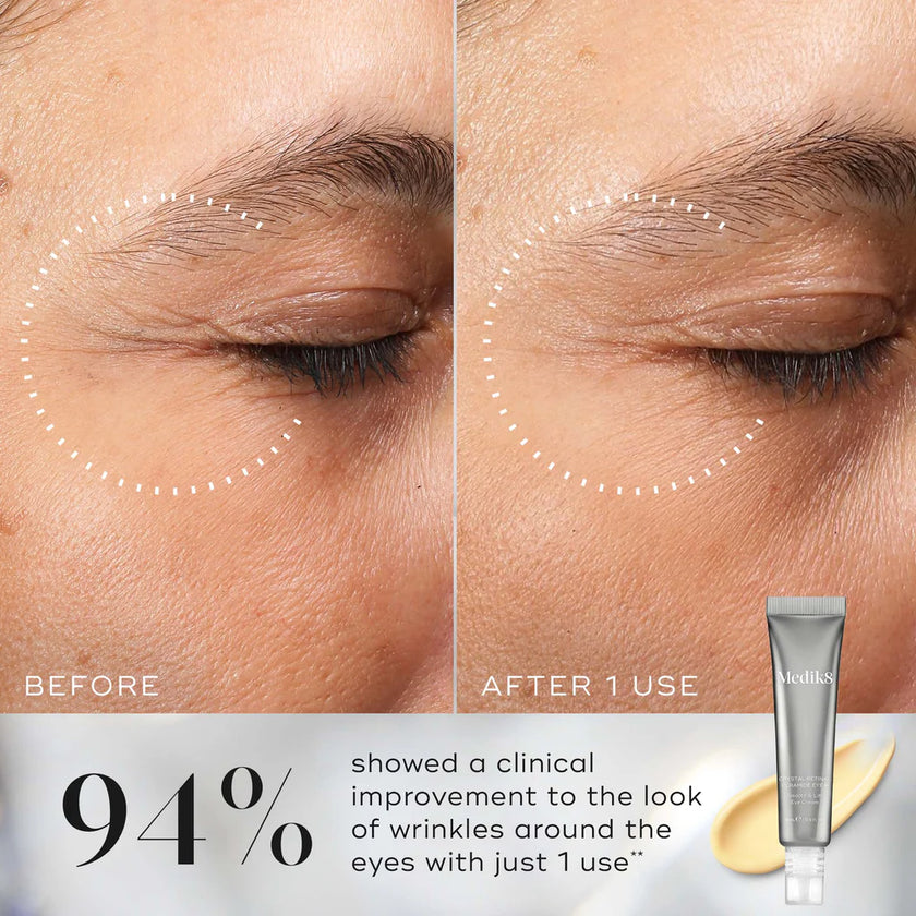 Medik8- Crystal Retinal Ceramide Eye 3